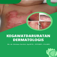 Kegawatdaruratan Dermatologis